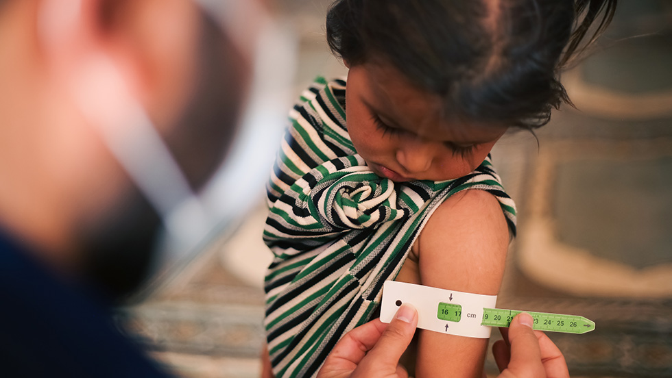 A healthcare worker measures the upper arm circumference of a young child using a MUAC (Mid-Upper Arm Circumference) tape, a standard screening tool for malnutrition. The child, wearing a green and white striped sleeveless top, looks down at the measurement being taken. The tape reads approximately 17 cm.